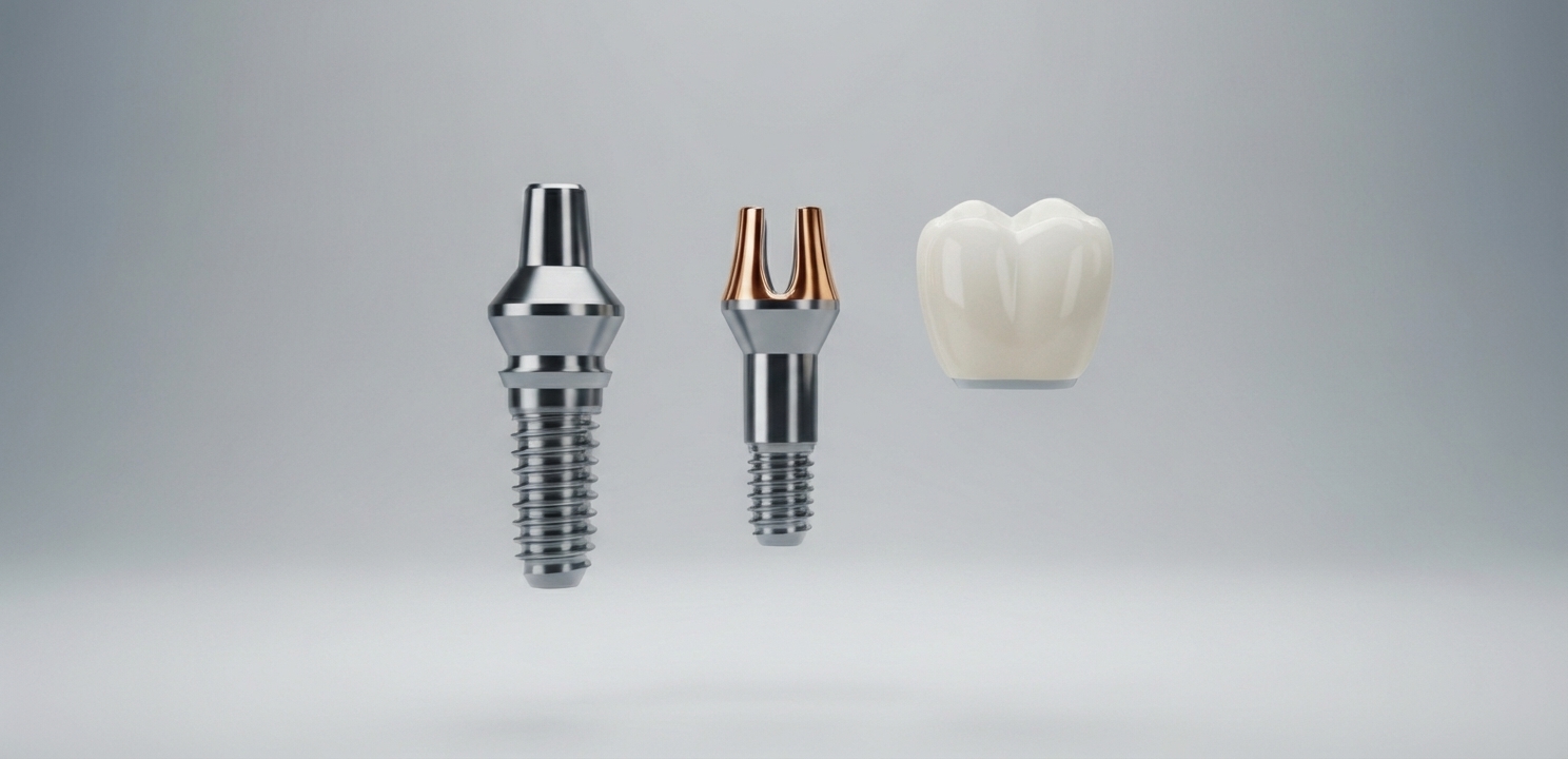 Tandimplantaten Nederland bestaan uit een implantaat, een abutment en een op maat gemaakte kroon.
