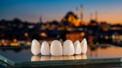 Een close-up van een set perfecte porseleinen facings op een steriele ondergrond, met op de achtergrond een prachtig wazig uitzicht op de skyline van Istanbul tijdens zonsondergang, wat het concept van tandtoerisme in Turkije illustreert.