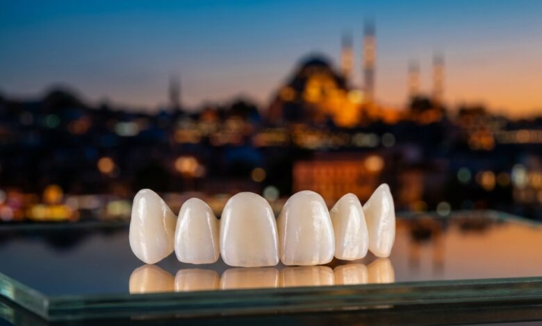 Een close-up van een set perfecte porseleinen facings op een steriele ondergrond, met op de achtergrond een prachtig wazig uitzicht op de skyline van Istanbul tijdens zonsondergang, wat het concept van tandtoerisme in Turkije illustreert.