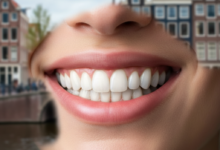 Close-up van een stralende, perfecte glimlach met witte en gelijkmatig gevormde tanden, tegen een zeer onscherpe achtergrond van een Nederlandse stad met gebouwen en water.