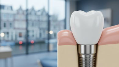 Een gedetailleerde, fotorealistische weergave van een gezonde kies met een subtiel zichtbaar, stevig geïntegreerd titanium tandimplantaat in het kaakbot en tandvlees. De scène is geplaatst in een moderne, schone tandartspraktijk met een onscherp uitzicht op hedendaagse Nederlandse architectuur op de achtergrond. Geen tekst of symbolen zichtbaar.