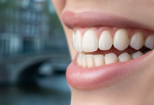 Close-up van een gezond gebit met roze tandvlees en witte tanden, tegen een zeer vervaagde achtergrond van een Nederlandse stad. De focus ligt op optimale mondgezondheid na een tandvleesbehandeling.